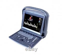 Deal-Chison ECO5 Color Doppler Ultrasound with One probe 2 years warranty