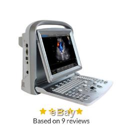 Demo model Chison ECO5 Ultrasound with one probe-Warranty 2 years